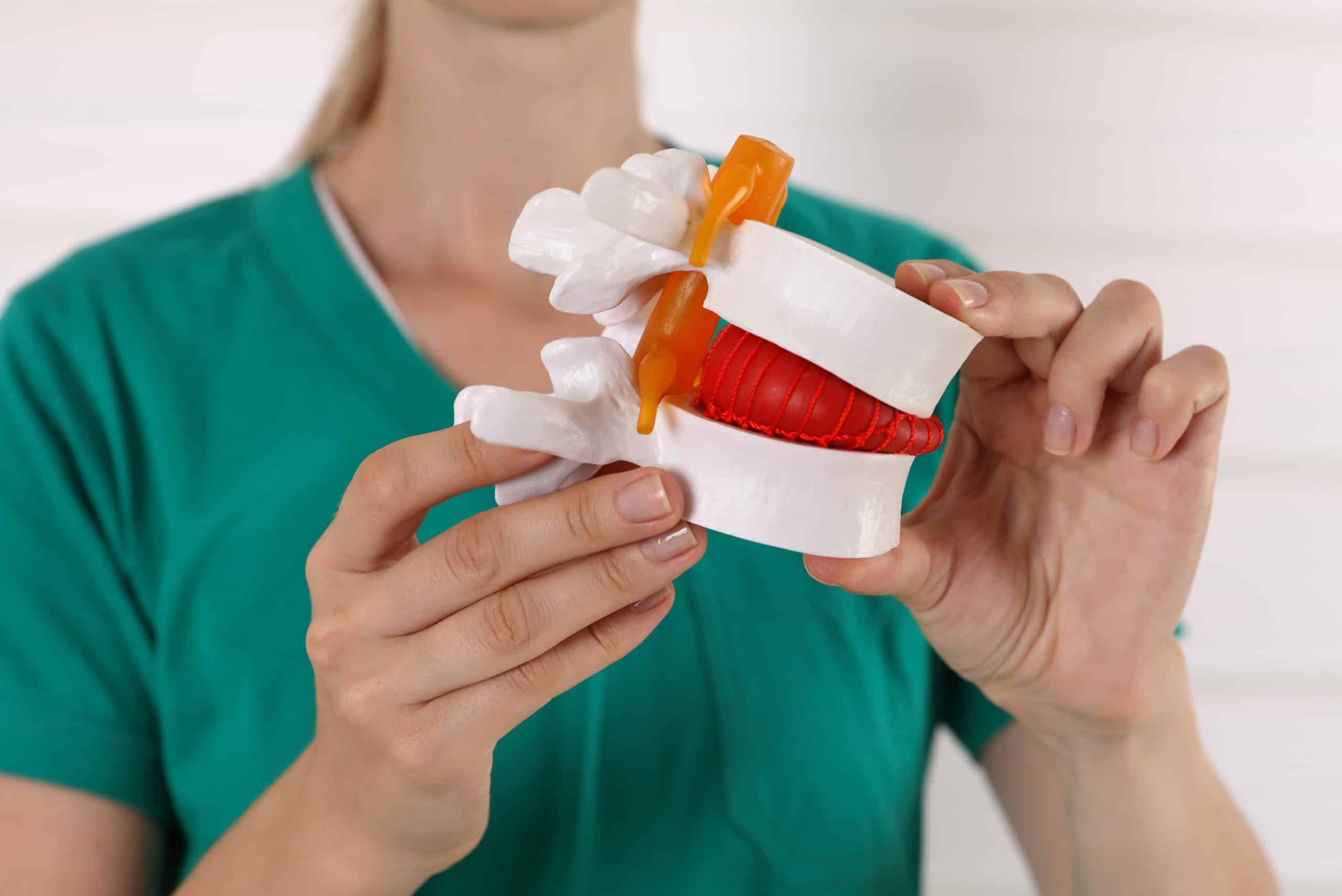 AdobeStock_372093474-scaled A female doctor in a green shirt holding a spine column module showing a bulging disc