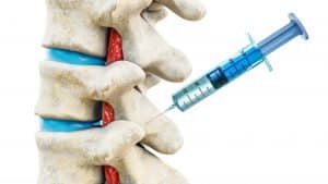 Facet joint injection procedure for spine pain