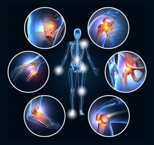 A set of six painful joints, medical 3D illustration.