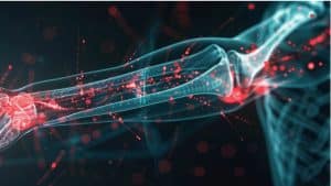 A diagram of the nerves in the arm