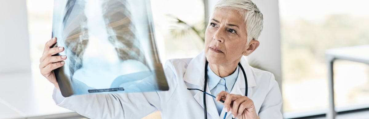 Heart Disease Symptoms You Need to Know (73) A doctor examines a spinal X-ray to determine the best vertebral compression fracture treatments for patients