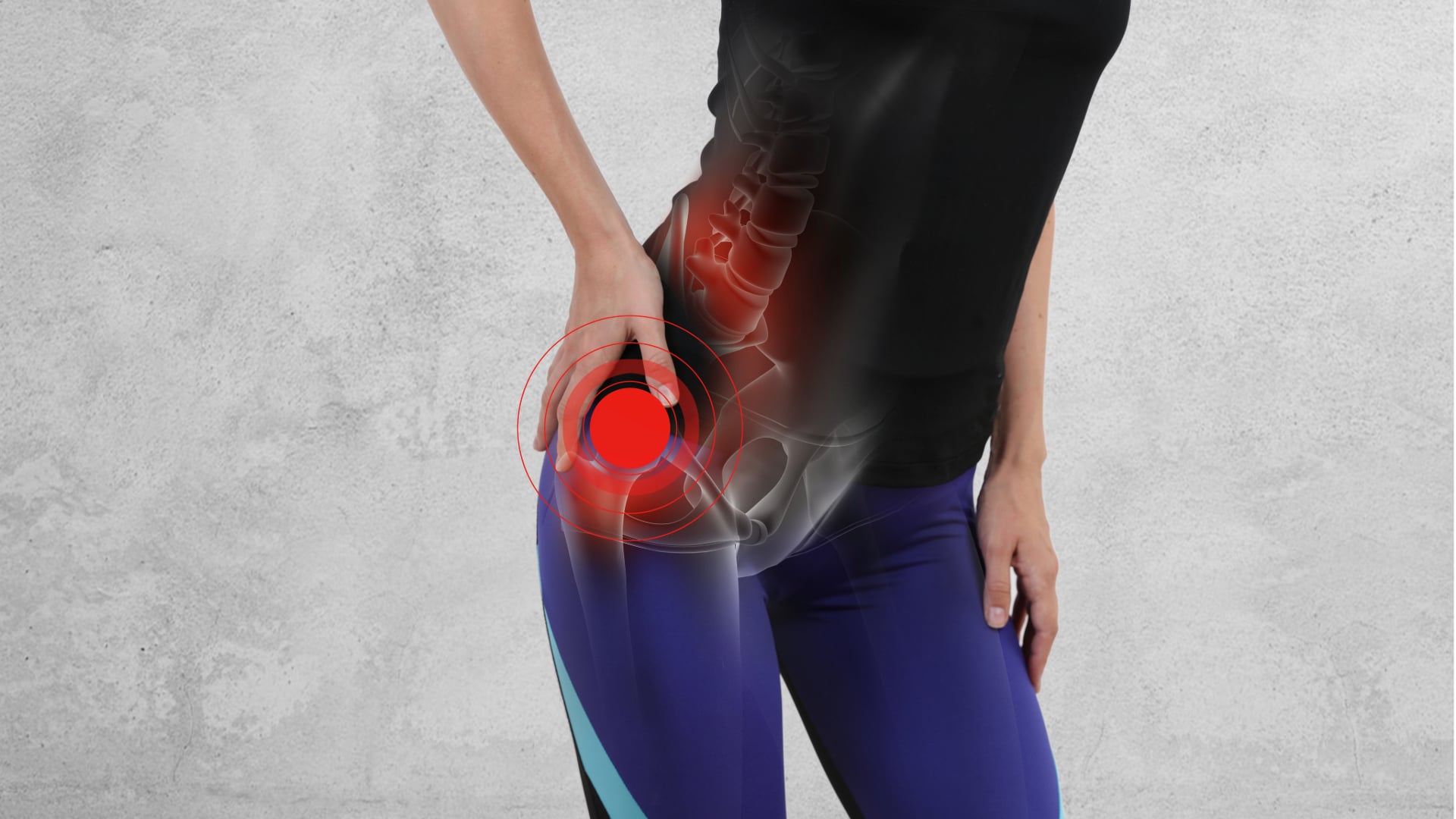 Hip-4 A women holding her hip while suffering hip pain.