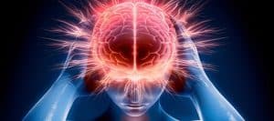 A illustrated image of the brain reacting to migraine pain