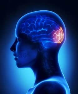 Blue graphic showing the treatment area of an occipital nerve block