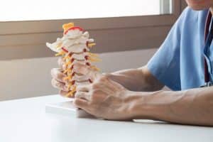Debunking 4 Common Myths About Lumbar Spinal Stenosis
