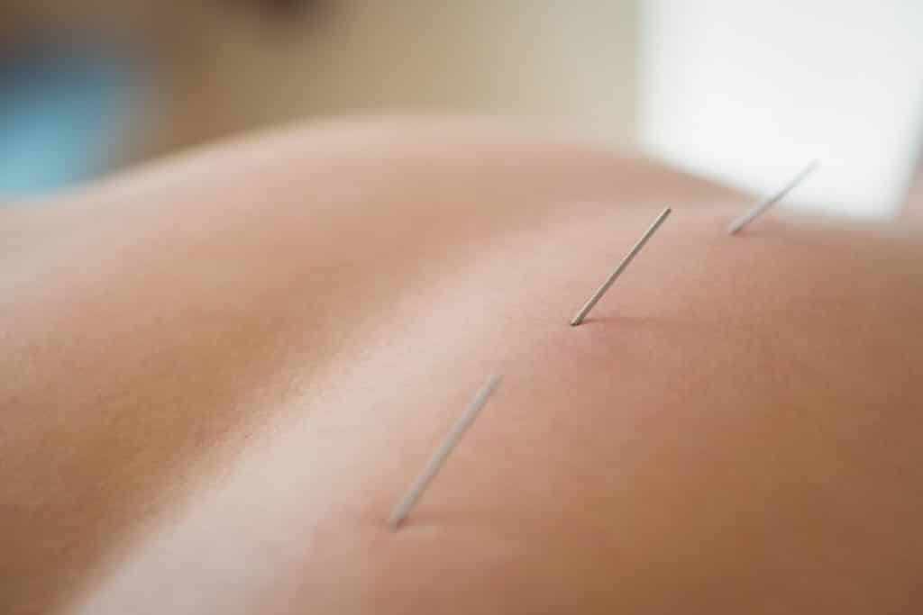 7 Ways to Treat Chronic Back Pain Without Surgery | Back Pain Doctors