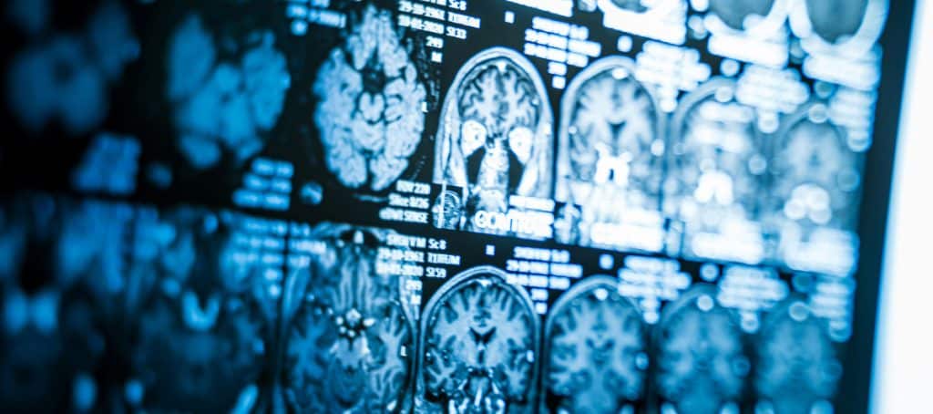 An image of illuminated brain scans