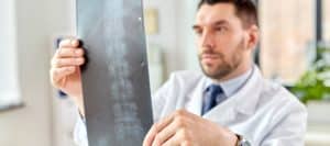 A doctor looks at a back X-ray as he considers the different types of spine surgery