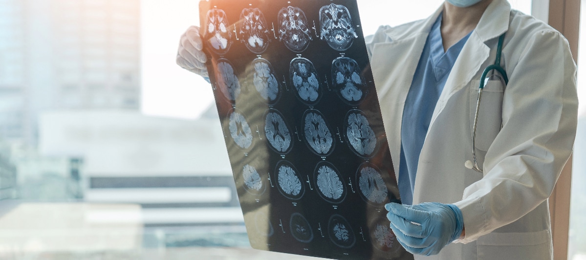 occipital-1-trigger point injections A neurologist review of patient xray of patients head and brain.