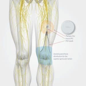 A human leg with the knee area highlighted in blue.